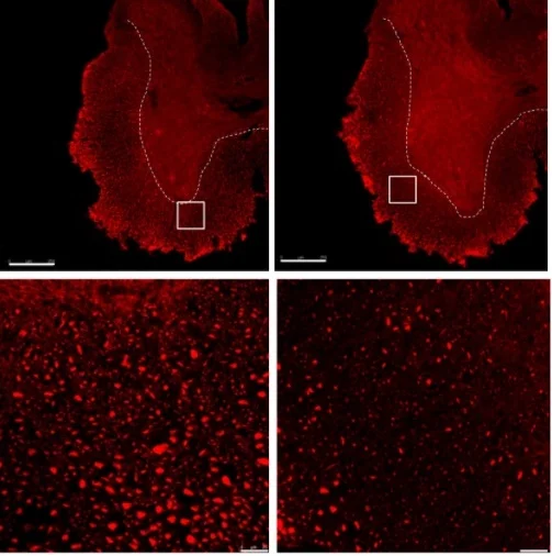 Un estudio liderado por investigadores REEM del Instituto Cajal muestra los cambios asociados al envejecimiento inmunológico en un modelo de EM progresiva